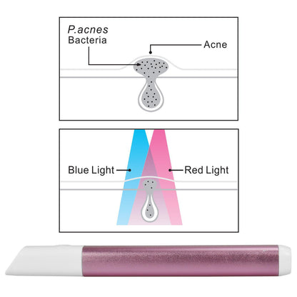 Light Therapy Acne Spot Treatment - Pink AS-61683