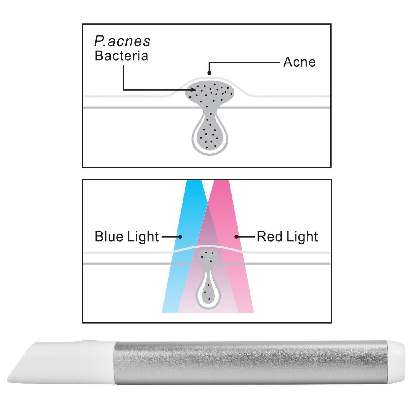 Light Therapy Acne Spot Treatment - SILVER AS-61683